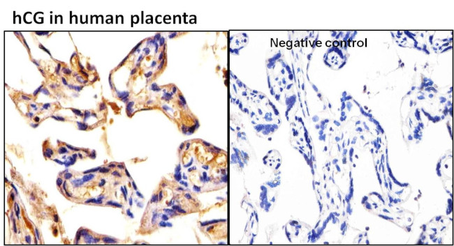 hCG Antibody in Immunohistochemistry (Paraffin) (IHC (P))