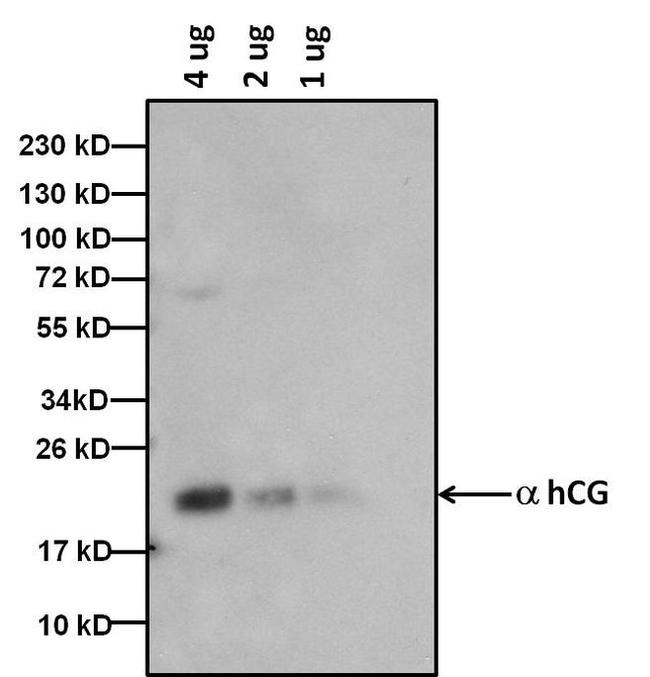 hCG Antibody in Western Blot (WB)