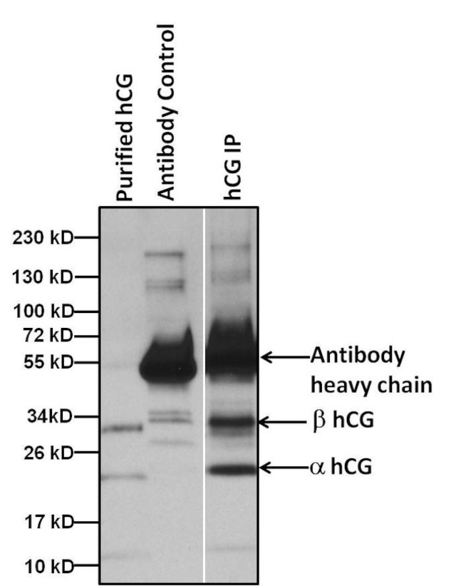 hCG Antibody in Immunoprecipitation (IP)