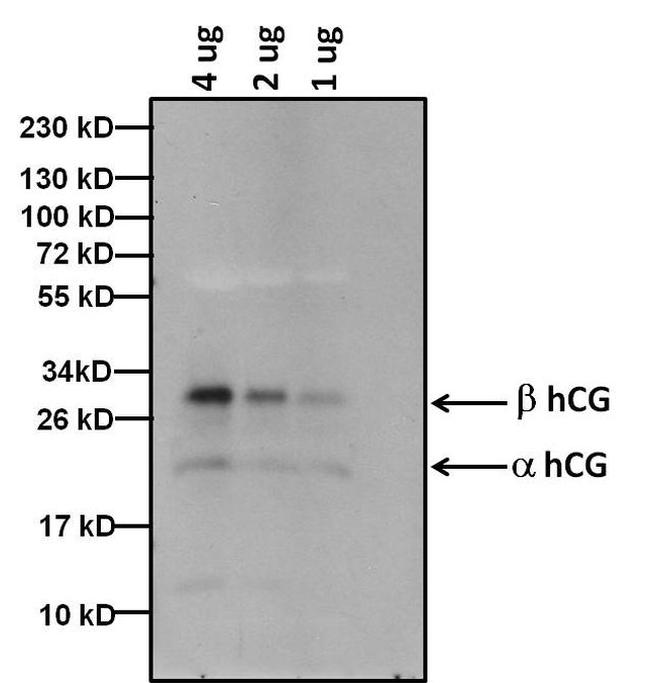 hCG Antibody in Western Blot (WB)