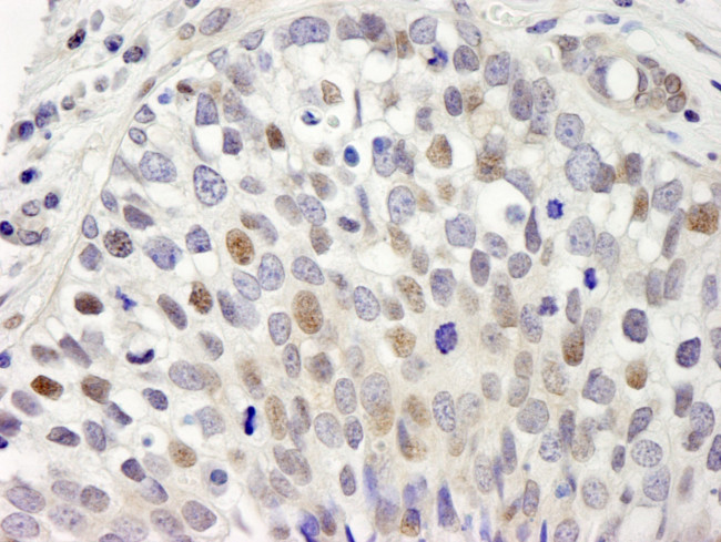 hSET1 Antibody in Immunohistochemistry (IHC)