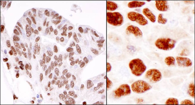 hnRNP-K Antibody in Immunohistochemistry (IHC)