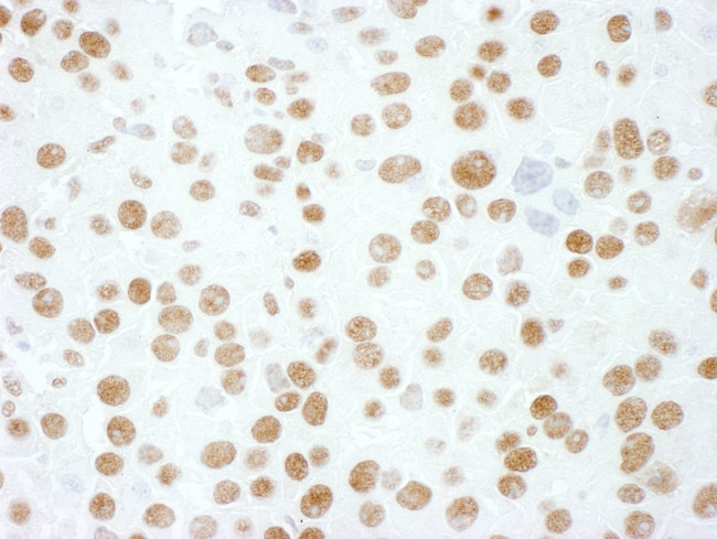 hnRNP M3/4 Antibody in Immunohistochemistry (IHC)