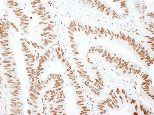 hnRNP M3/4 Antibody in Immunohistochemistry (IHC)