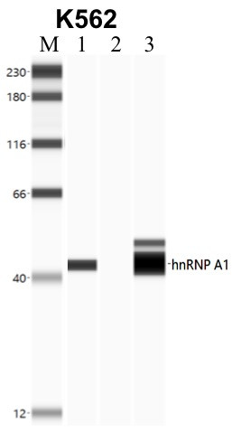 hnRNP A1 Antibody in Immunoprecipitation (IP)