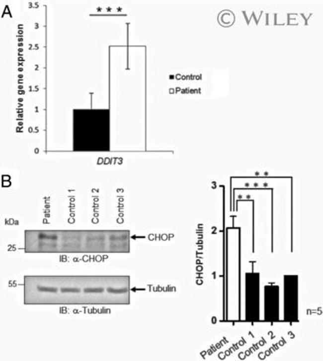 CHOP Antibody in Western Blot (WB)