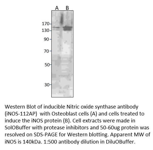 iNOS Antibody in Western Blot (WB)