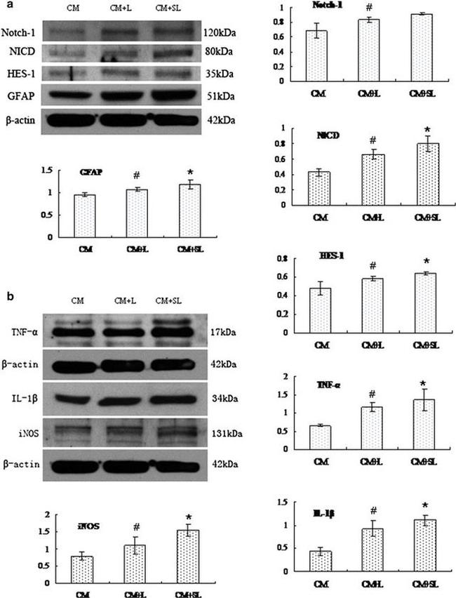 iNOS Antibody in Western Blot (WB)