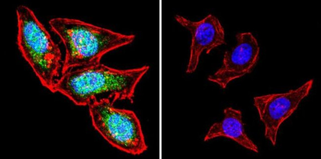 iNOS Antibody in Immunocytochemistry (ICC/IF)