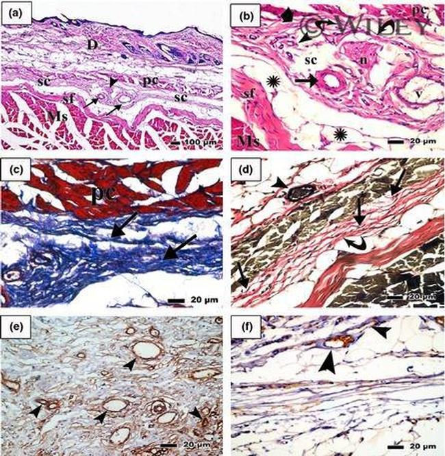 CD34 Antibody in Immunohistochemistry (IHC)