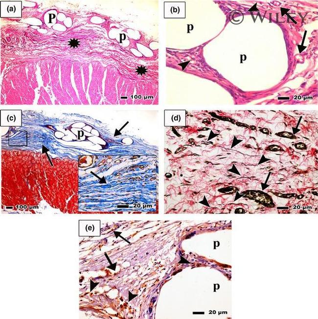 CD34 Antibody in Immunohistochemistry (IHC)