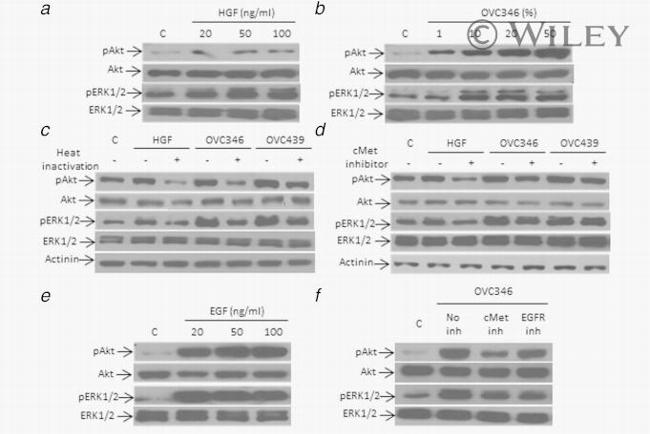 Phospho-AKT1 (Ser473) Antibody in Western Blot (WB)