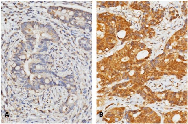 CLCA1 Antibody in Immunohistochemistry (IHC)