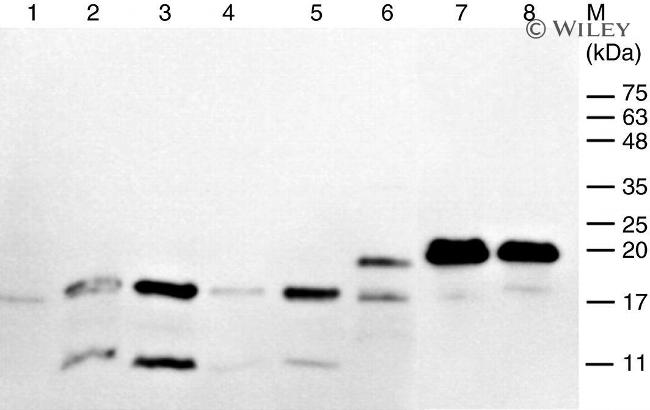 Penta-His Tag Antibody in Western Blot (WB)