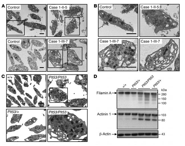 Filamin A alpha-2 Antibody in Western Blot (WB)