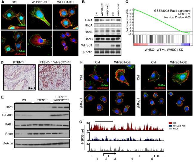 RAC1 Antibody in Immunocytochemistry (ICC/IF)