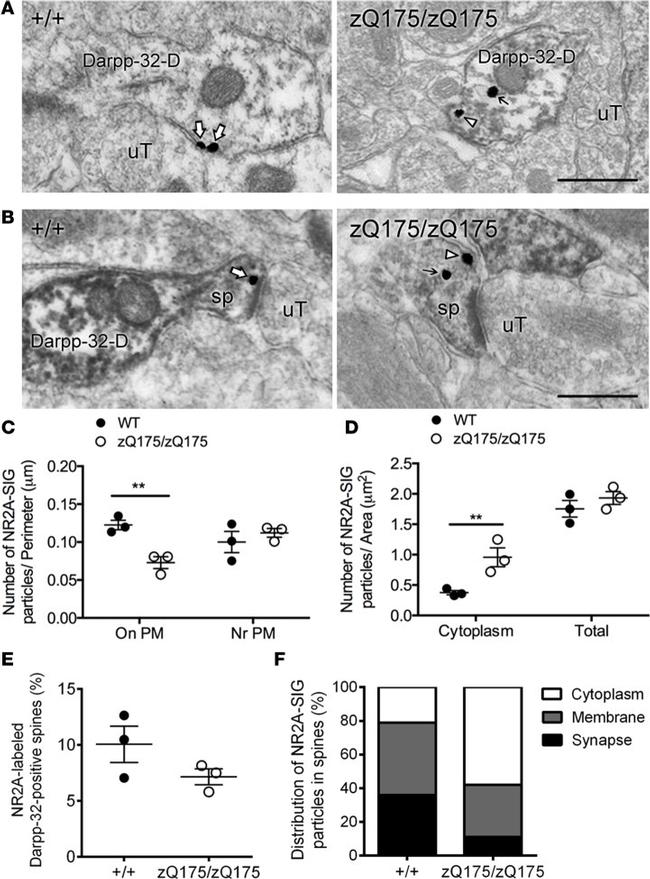 NMDAR2A Antibody in Immunomicroscopy (IM)