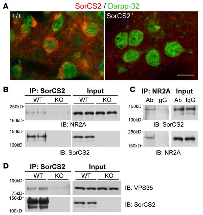 NMDAR2A Antibody in Western Blot (WB)