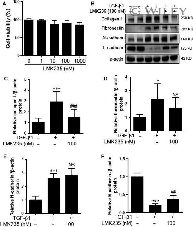 Fibronectin Antibody in Western Blot (WB)