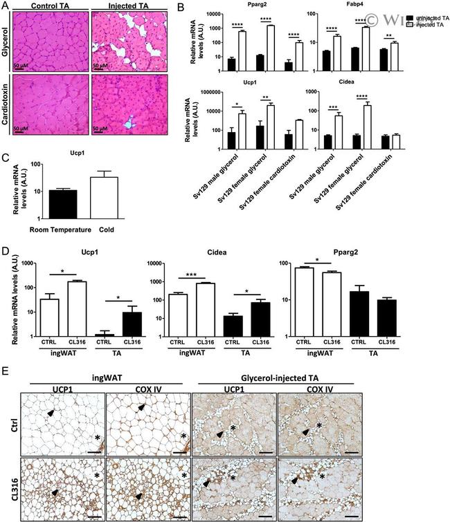 UCP1 Antibody in Immunohistochemistry (Paraffin) (IHC (P))