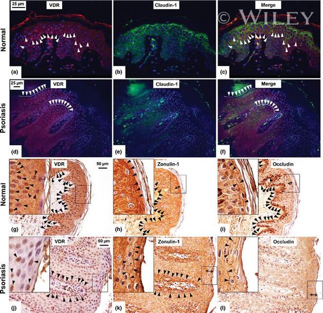 ZO-1 Antibody in Immunohistochemistry (Paraffin) (IHC (P))