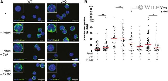 NFATC2 Antibody in Immunocytochemistry (ICC/IF)