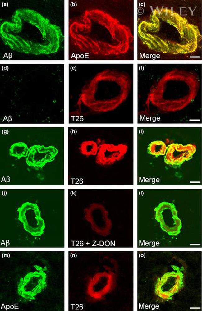 beta Amyloid Antibody in Immunohistochemistry (IHC)