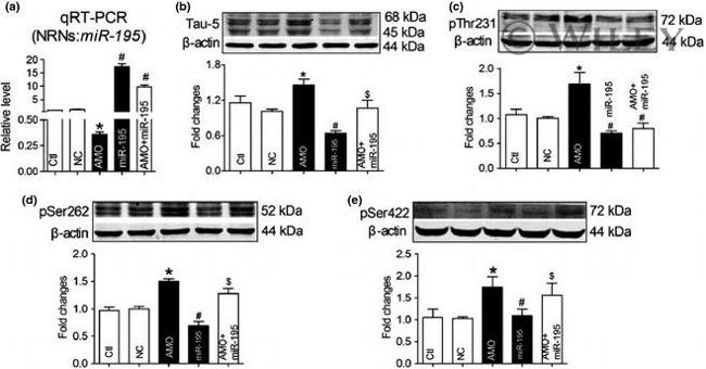 Phospho-Tau (Thr231) Antibody in Western Blot (WB)