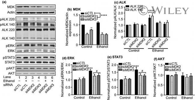 ALK Antibody in Western Blot (WB)