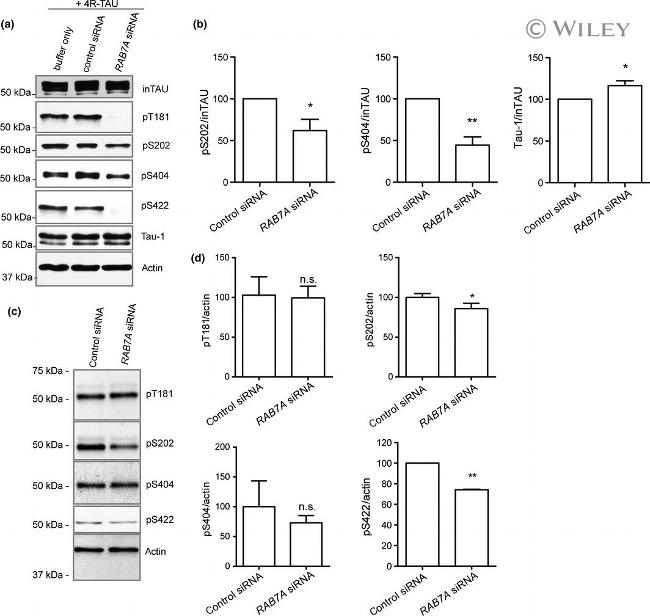 Phospho-Tau (Ser199, Ser202) Antibody in Western Blot (WB)