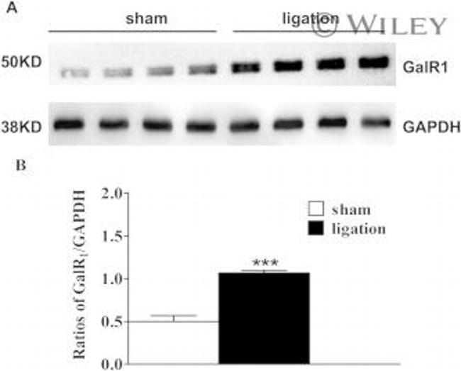 GALR1 Antibody in Western Blot (WB)