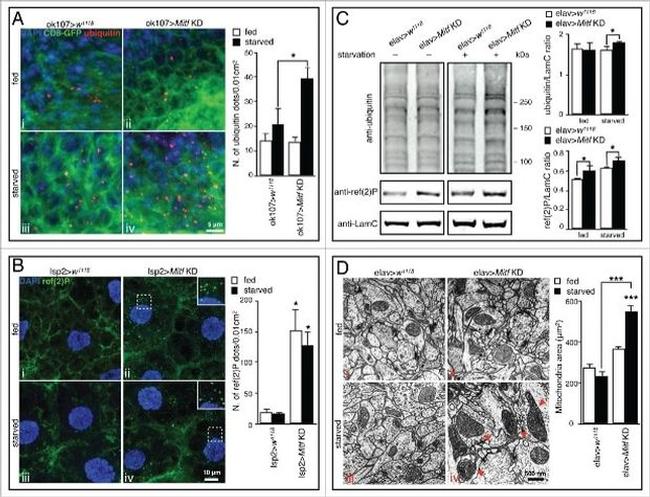 Ubiquitin Antibody in Immunohistochemistry (IHC)