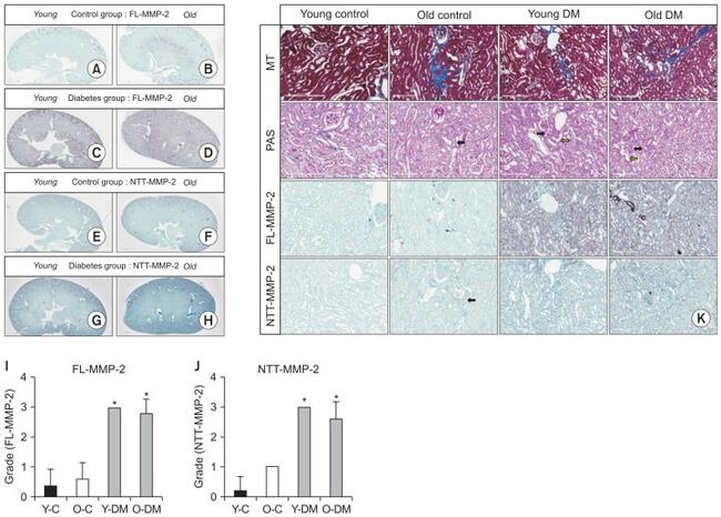 MMP2 Antibody in Immunohistochemistry (Paraffin) (IHC (P))