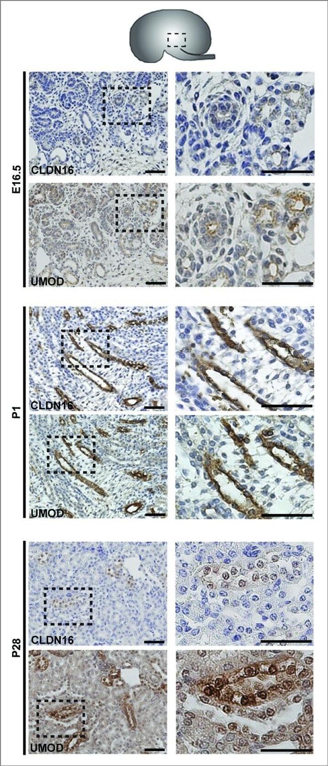 Claudin 16 Antibody in Immunohistochemistry (IHC)