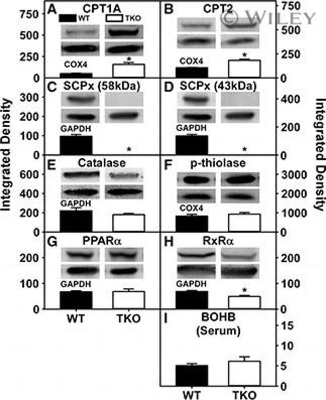 PPAR alpha Antibody in Western Blot (WB)