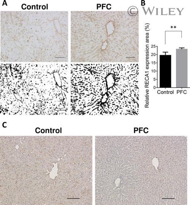 ICAM-1 Antibody in Immunohistochemistry (Frozen) (IHC (F))