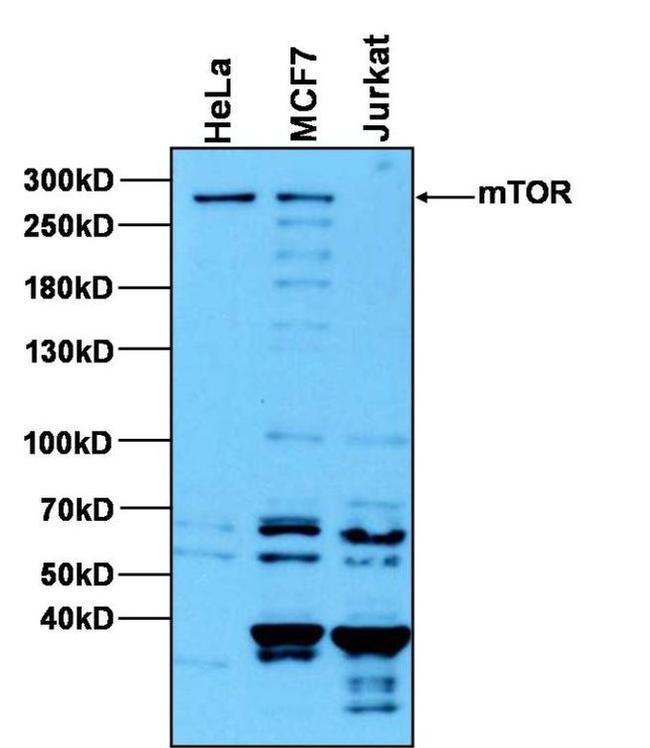 mTOR Antibody in Western Blot (WB)