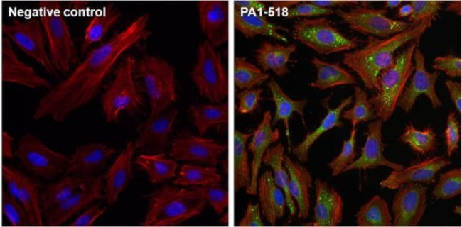 mTOR Antibody in Immunocytochemistry (ICC/IF)