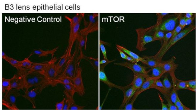 mTOR Antibody in Immunocytochemistry (ICC/IF)