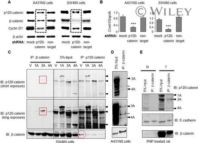 delta Catenin Antibody in Western Blot (WB)