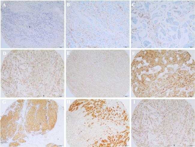 Claudin 4 Antibody in Immunohistochemistry (IHC)