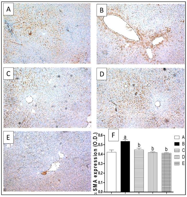 Actin Antibody in Immunohistochemistry (IHC)