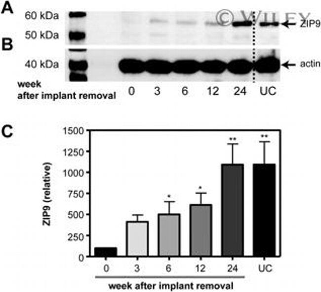 SLC39A9 Antibody in Western Blot (WB)