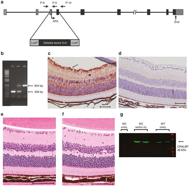 CRALBP Antibody in Immunohistochemistry (IHC)