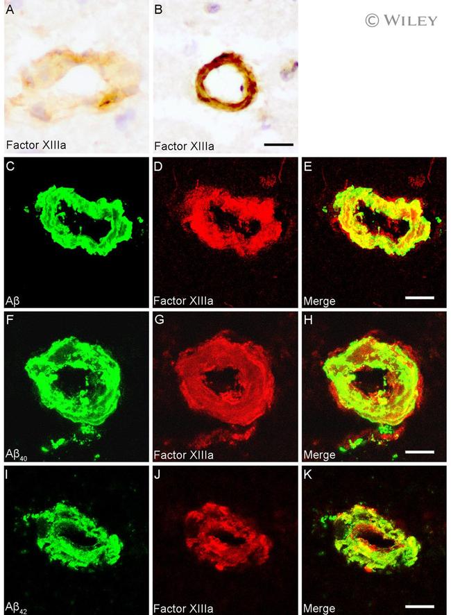 beta Amyloid Antibody in Immunohistochemistry (IHC)