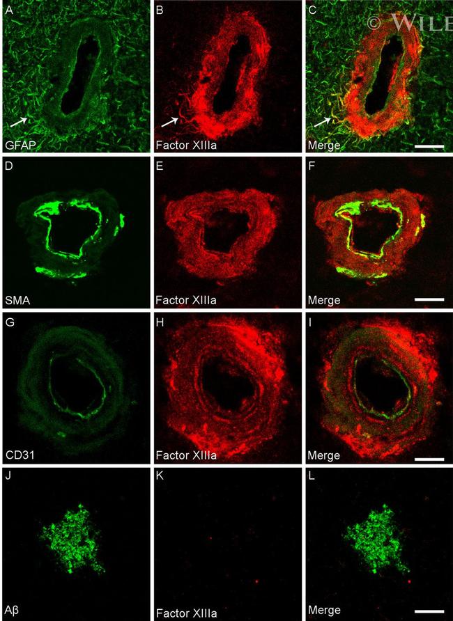 beta Amyloid Antibody in Immunohistochemistry (IHC)