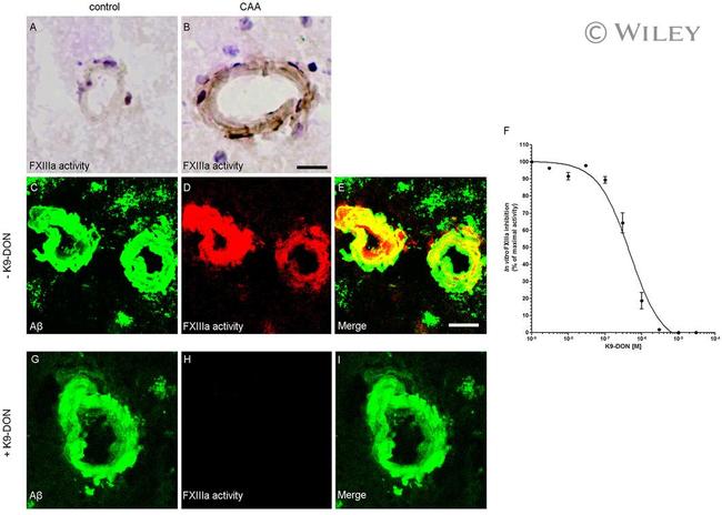 beta Amyloid Antibody in Immunohistochemistry (IHC)