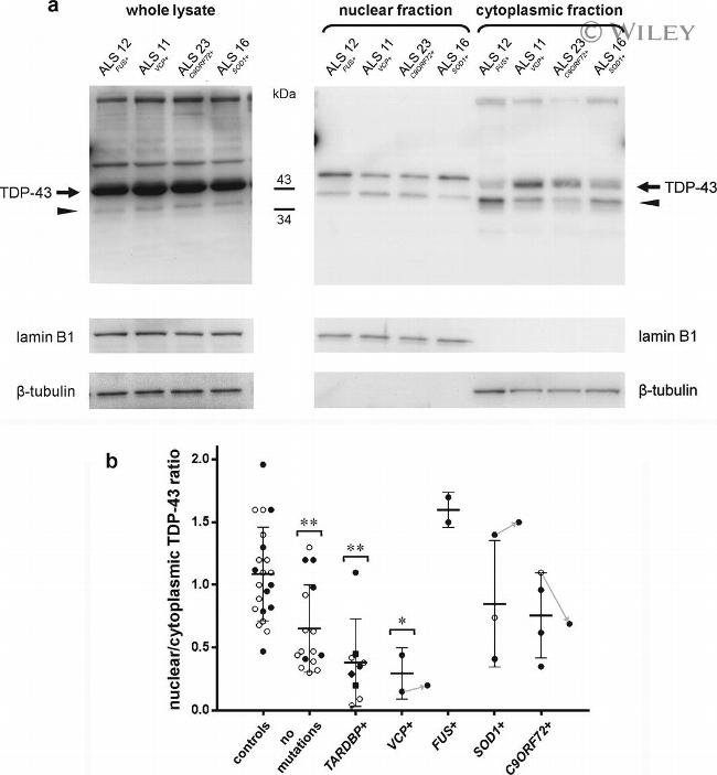 Lamin B1 Antibody in Western Blot (WB)