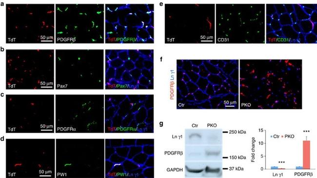 CD140b (PDGFRB) Antibody in Western Blot, Immunohistochemistry (WB, IHC)