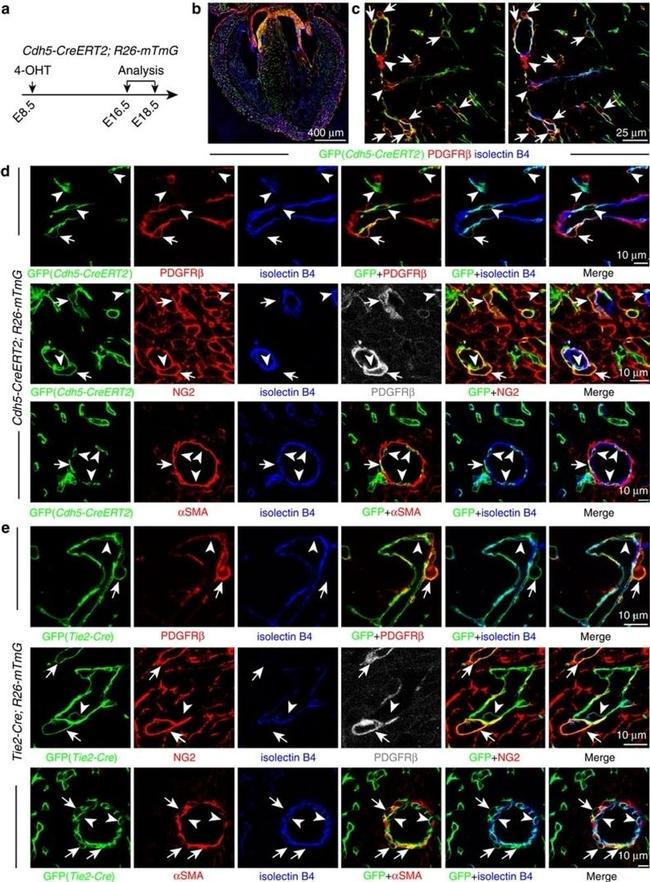 Alpha-Smooth Muscle Actin Antibody in Immunohistochemistry (IHC)